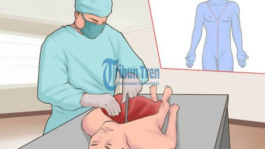 Update Terbaru Kasus Yu Menglong! Hasil Autopsi Diduga Bocor